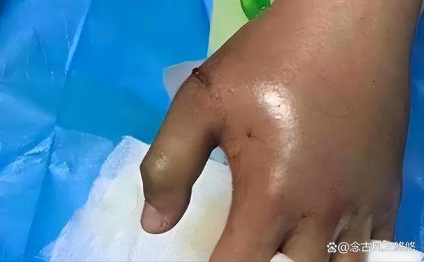 被蛇咬反抓蛇再遭咬,被蛇咬反抓蛇再遭咬伤