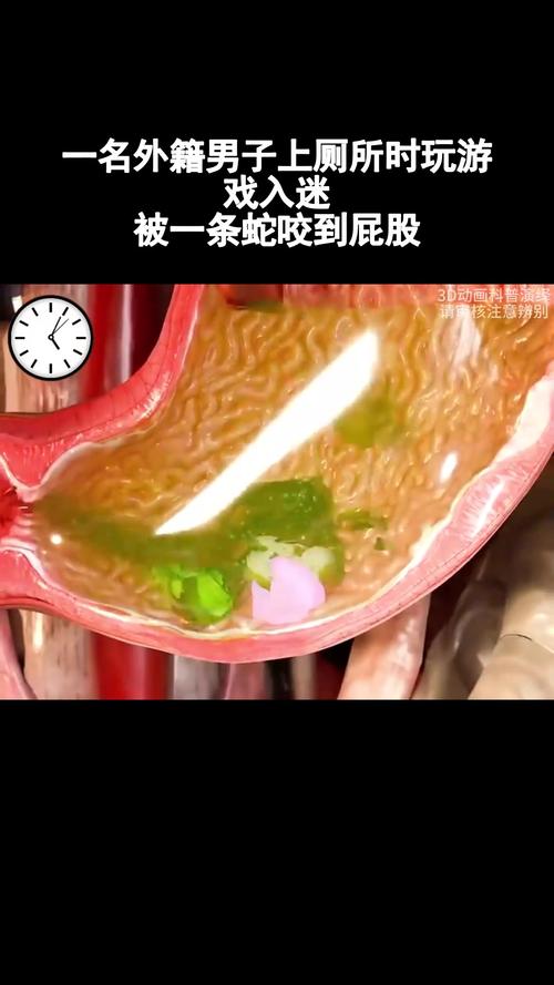 因好奇徒手抓蛇被咬,因好奇徒手抓蛇被咬了