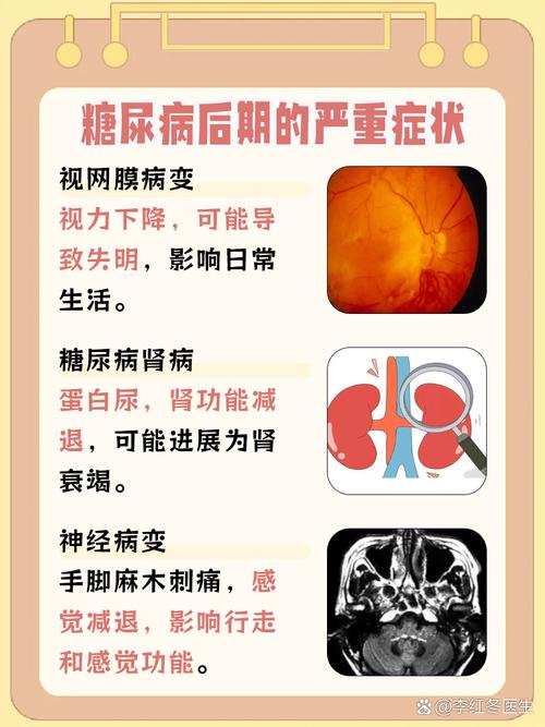 代谢变差的6个表现,代谢不好有哪些症状?