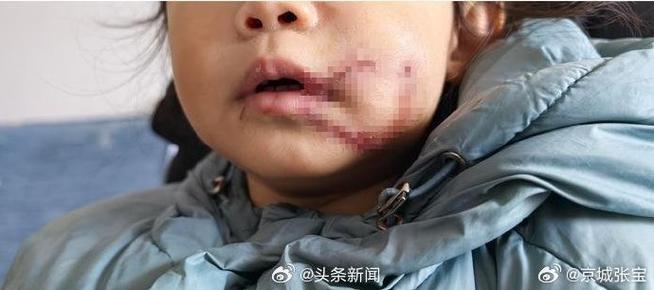 狗闯村民家咬伤女童,村里的狗咬人,应该找谁解决