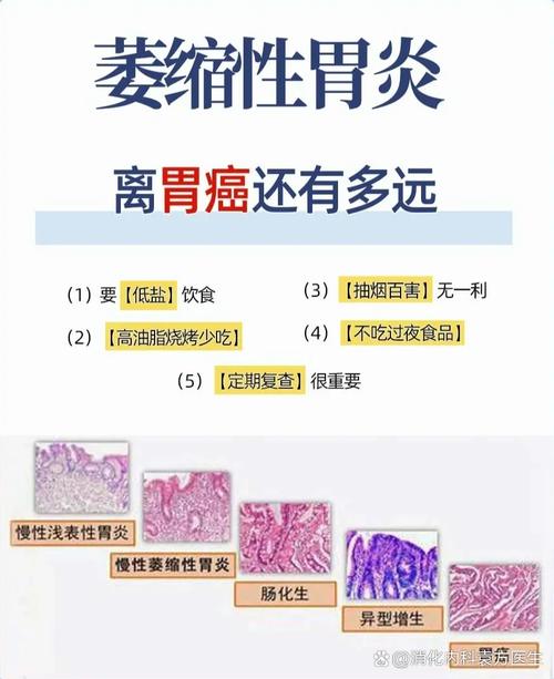 胃炎被当癌症切全胃,医生告知说3种胃病是癌前病变,哪3种?