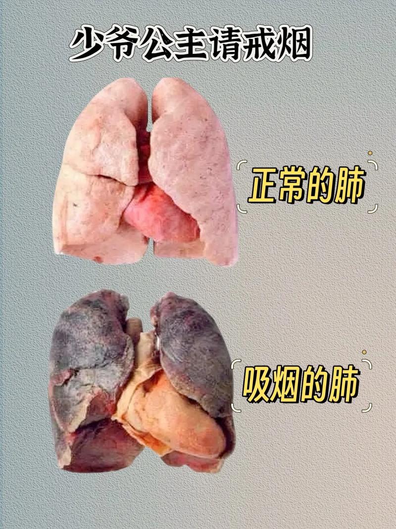 吸烟如何摧毁你的肺,吸烟对肺的影响有多大危害?