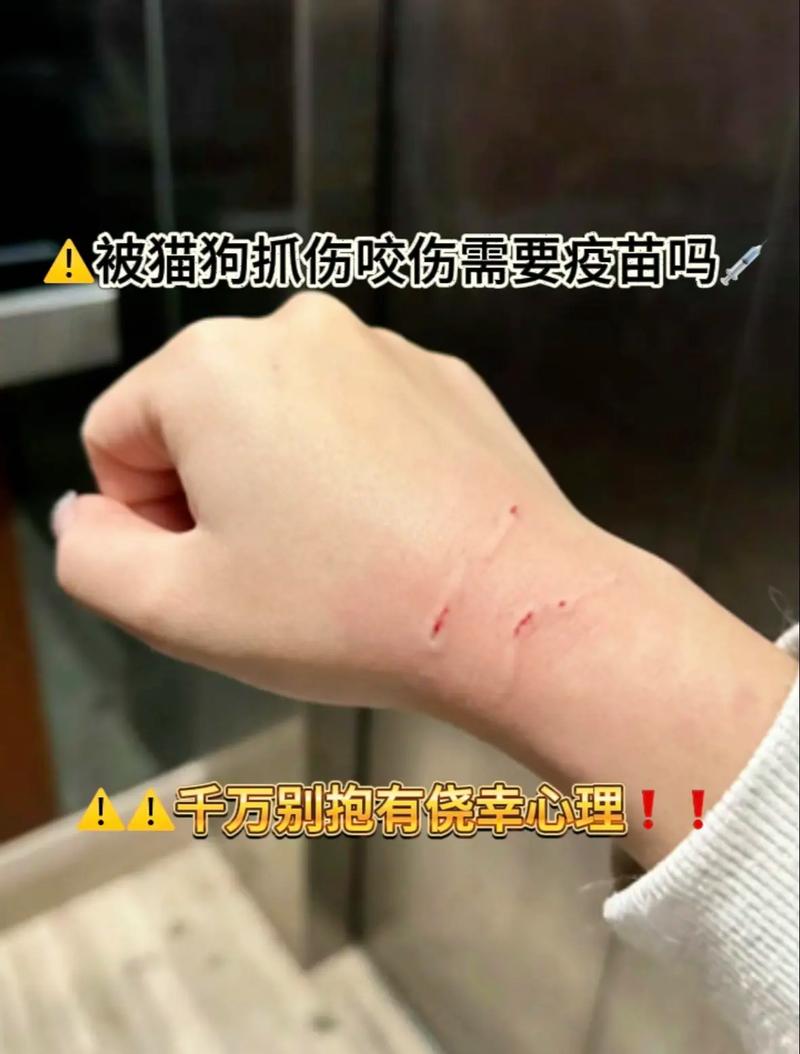 被40只狗围咬致死,被40只狗围咬致死案例