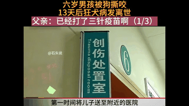 被狗咬3个月后去世,男孩被狗咬去世,狂犬病如何进行急救?