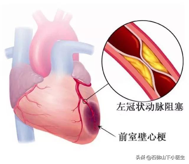 化工厂爆炸10死20伤,化工厂发生爆炸3死6伤 化工厂爆炸10死20伤,化工厂发生爆炸3死6伤