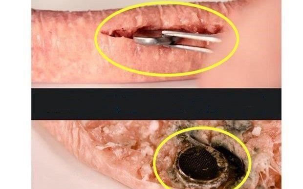 2岁娃误吞纽扣电池,小孩子把纽扣电池吞进肚子怎么办?