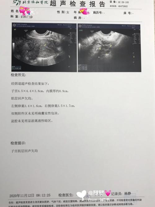 痛经去医院结果生了,孕晚期有大便和痛经感是快生了吗?
