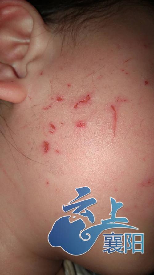 8岁女童被车撞身亡,南阳8岁小学生下校车后过马路被撞身亡,谁该担责?