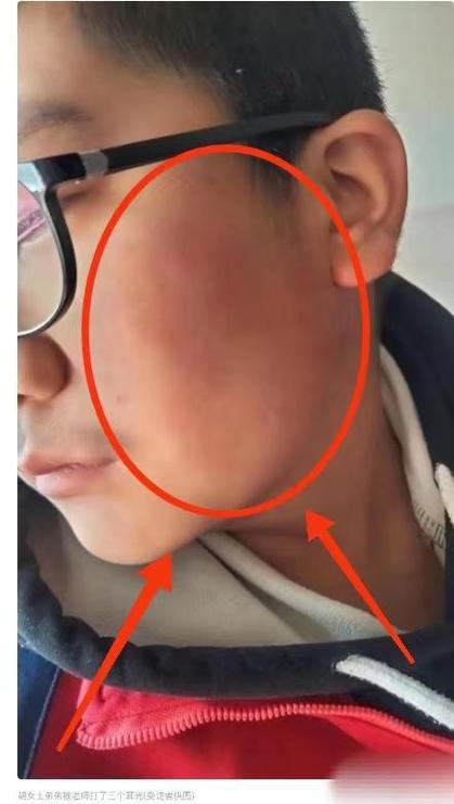 让女儿跪门口扇巴掌,女儿遭遇班主任扇耳光,脸都打肿了?