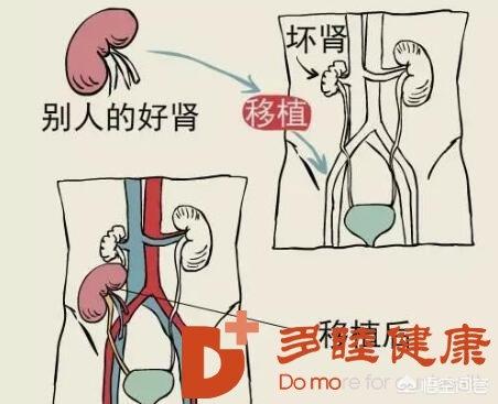 女大学生尿毒症晚期,尿毒症晚期能治好吗？