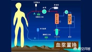 富豪与儿子置换血浆,血浆置换什么意思？