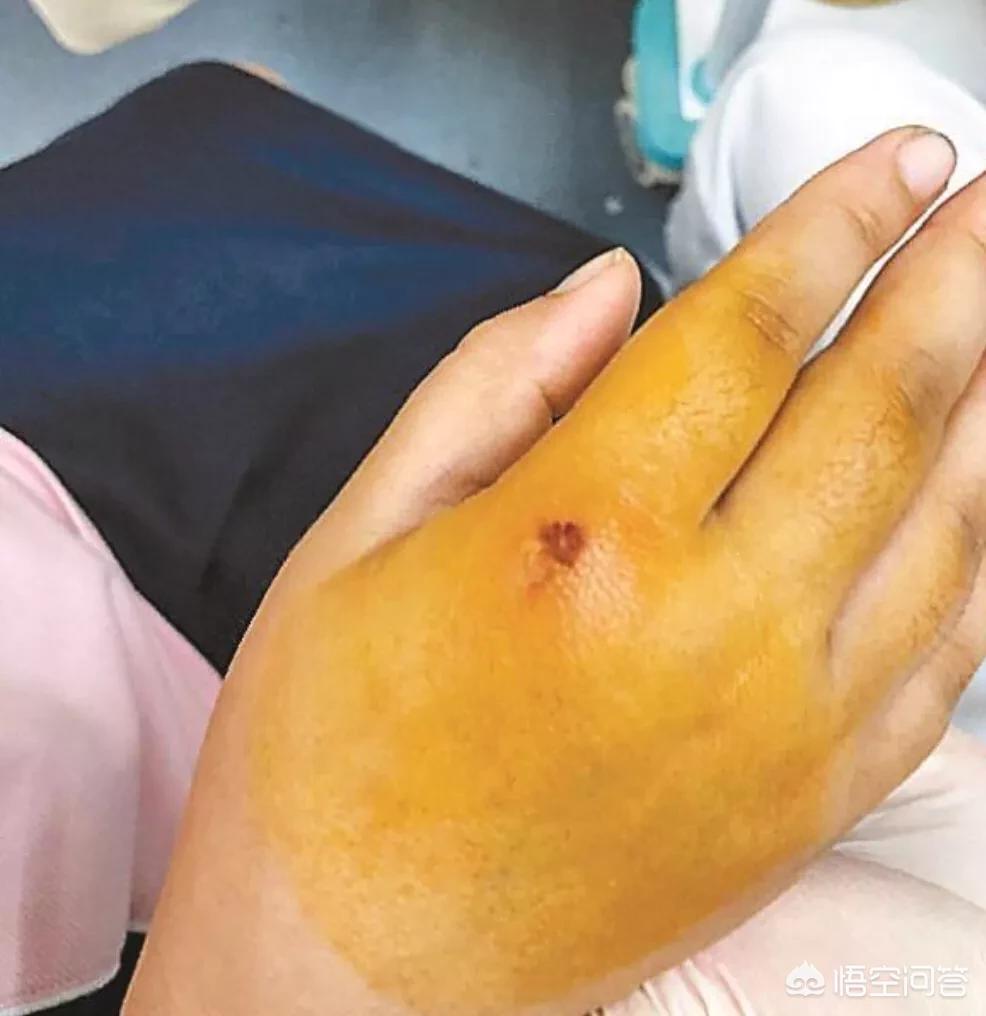 未牵绳大狗扑1岁娃,带着小孩在路上遇到没有牵绳的狗扑过来，怎么打狗？