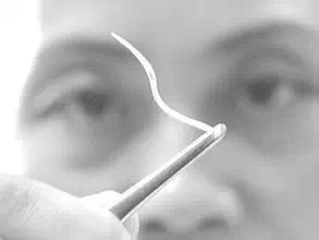 医生被举报乱收费,拔鱼刺收费40元，医生被投诉，患者是什么心理？