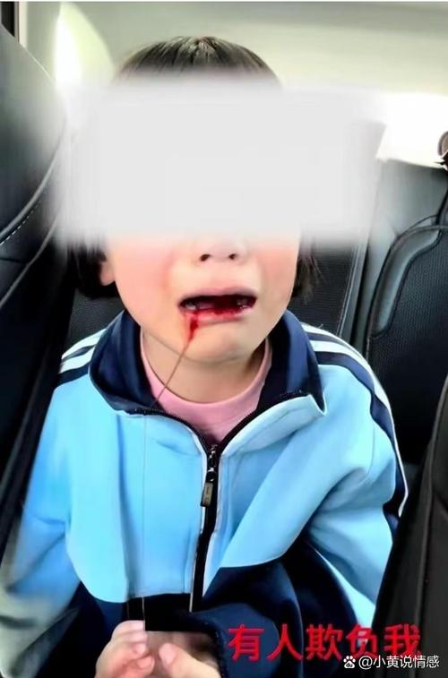 刀插入3岁女童颅脑,刀插在脑子里就没痛觉了吗