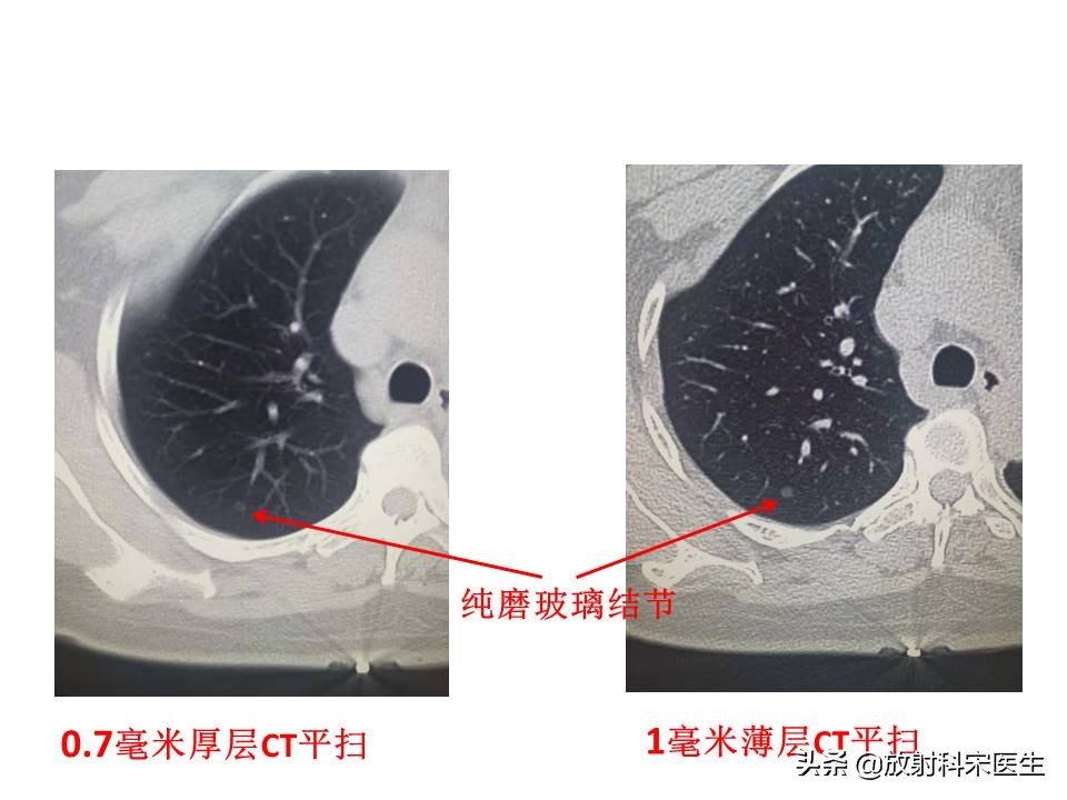 弄错CT图像致误诊,本人今年4月增强ct报告出现重大误诊，求问谁应该负责？