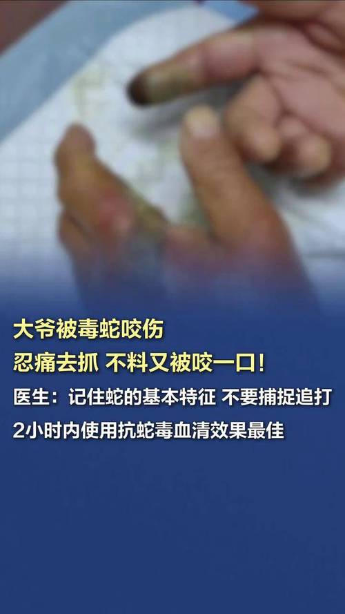 踩中在缠斗的蛇被咬,踩中在缠斗的蛇被咬了