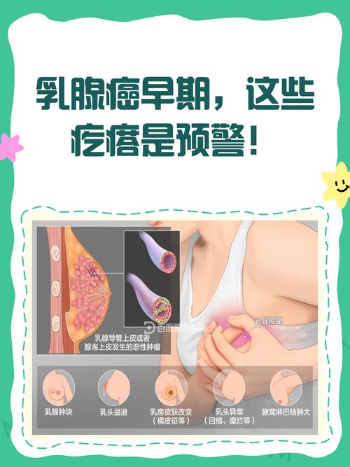 摸到疙瘩确诊乳腺癌,摸着胸部有肿块,是乳腺癌吗?