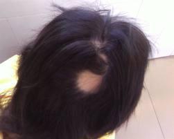 全国肥胖率分布地图,全国肥胖比例图表