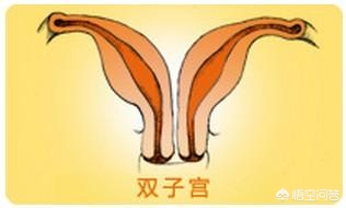 双子宫女子怀孕,双子宫对怀孕有影响吗？