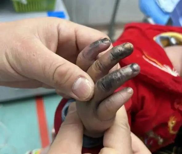 男童景观池触电身亡,3儿童疑在小区景观池触电