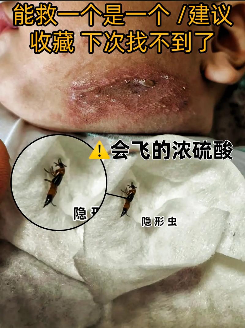 多地现行走的硫酸,河南多地现行走的硫酸