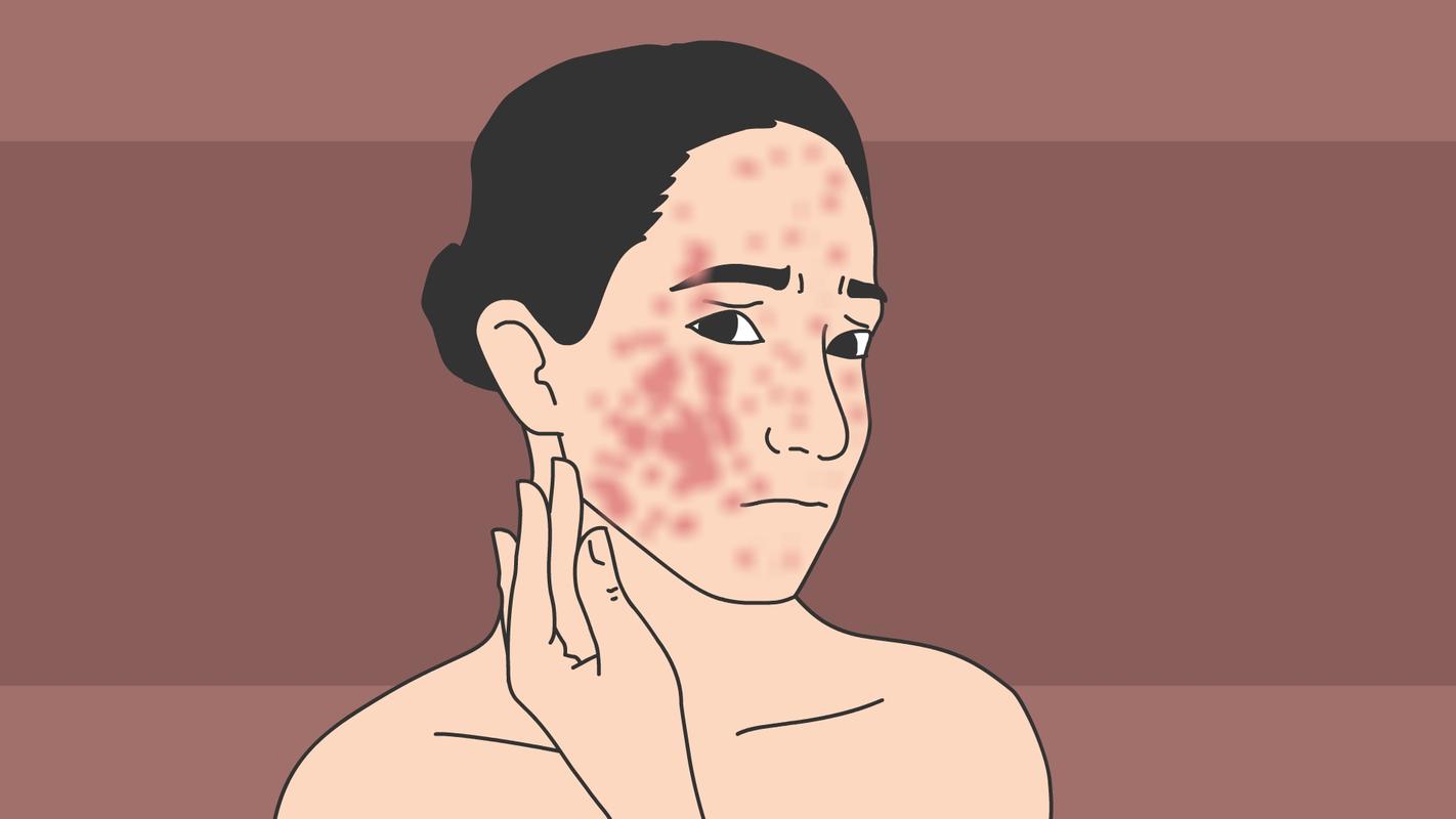 最疼皮肤病高发期,为什么每年春天,人的面部皮肤干裂、褪皮、痒痛?该如何调理?