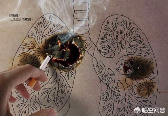 不抽烟的女性得肺癌,不吸烟的女性为何会得肺癌，该如何预防？