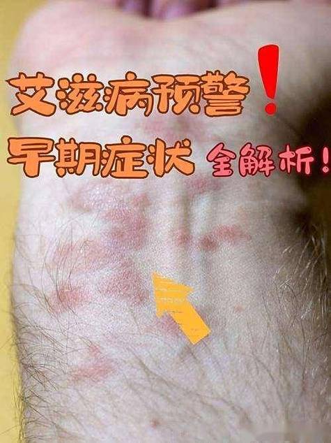 隐瞒艾滋10年无防护,如果有人明知自己有艾滋病却隐瞒,还与他(她)人结婚,那么有没有法律保护健康的一方?