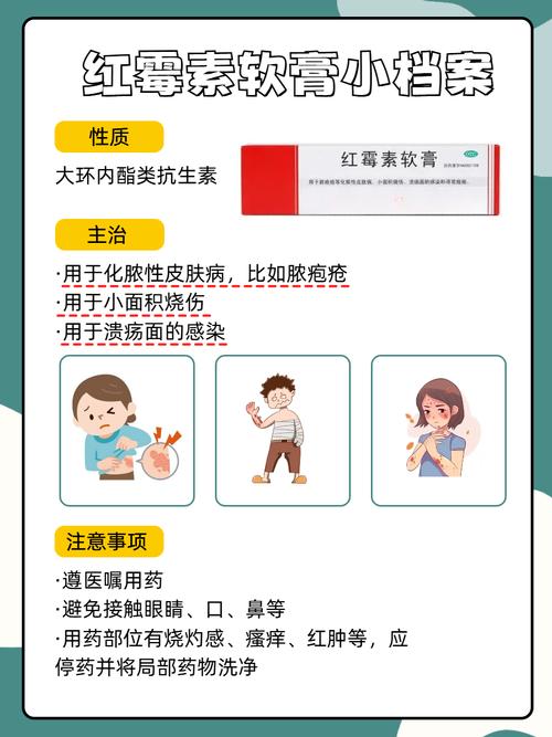 红霉素软膏别随便用,红霉素软膏可以直接涂脸吗?