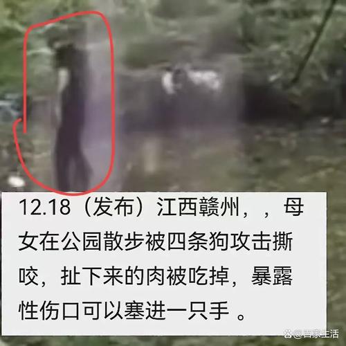 牵绳遛狗时被殴打,杭州女子为护子被遛狗不牵绳男子殴打,打人者哪里来的底气敢打人?