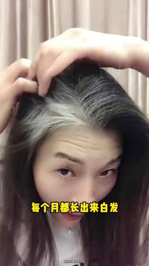 34岁妈妈满头白发,34岁染什么颜色看不出白头发?