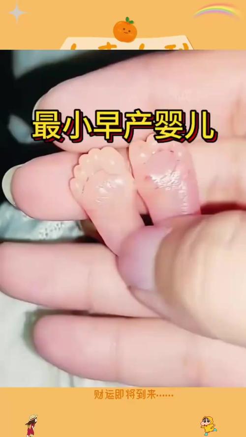 超市豆腐早产1天,武汉:“巴掌宝宝”出生时仅990克,精心救治如同呵护“嫩豆腐”,40名早产儿回医院参加“毕业典礼”, 你怎么看?