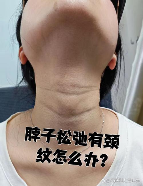 天鹅脖子疑被压变形,天鹅颈和普通脖子对比?