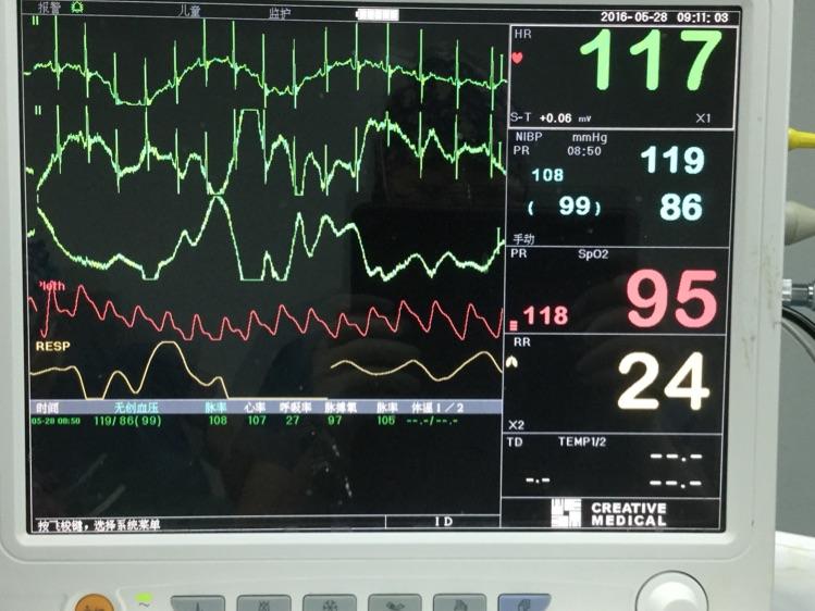 做切胃手术在ICU身亡,在医院过世流程？