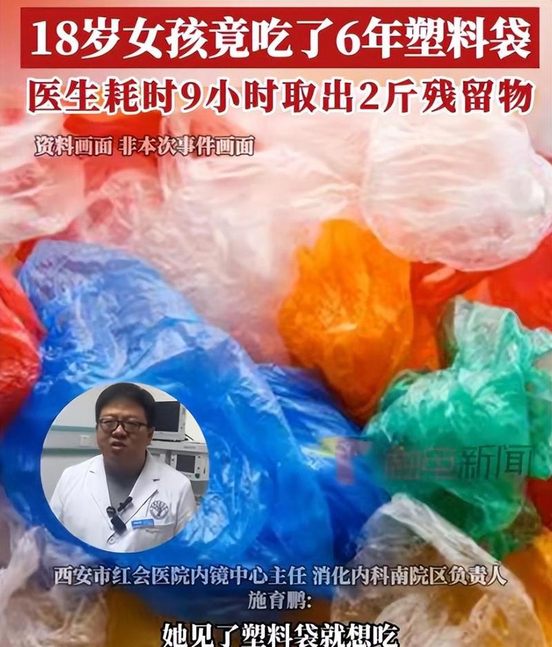 女子胃里现2斤塑料袋,牛吃了塑料袋有什么方法消化掉?