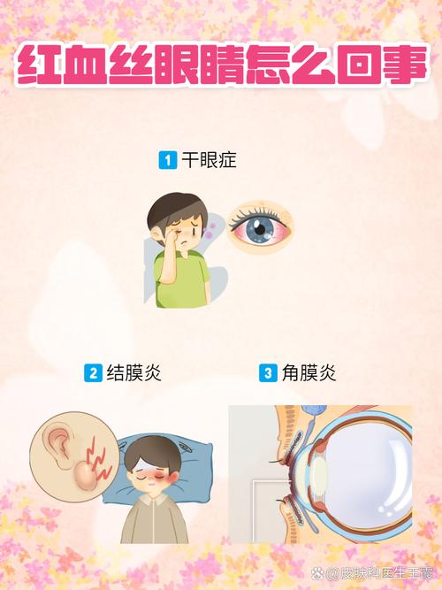 被激光射视力剩0.4,眼睛激光矫正后,眼里有血丝,会有什么严重后果吗?