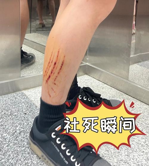 78岁演员倒地后去世,眼看90多岁邻居大娘上台阶摔倒,沈阳一78岁老工程师给小区安了21个扶手,你怎么看?