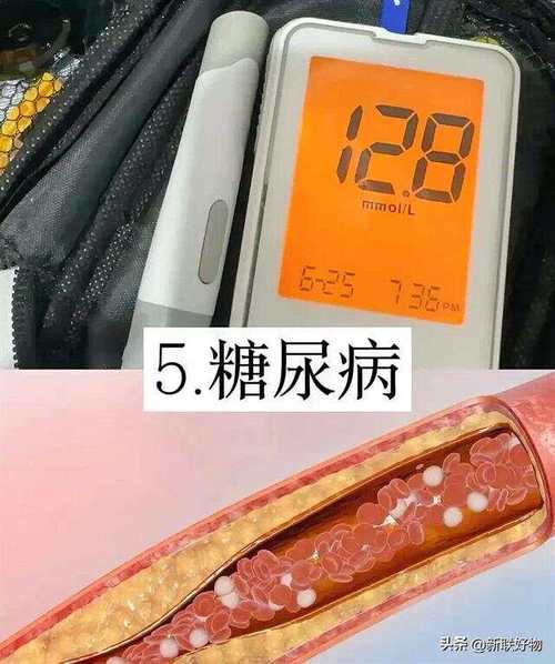 无法根治的10种病,人类有哪些疾病是无法治愈的?