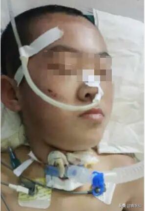 12岁女生遭体罚身亡,山西12岁女童疑遭继母殴打虐待致脑梗死，昏迷多日，怎么回事吗？