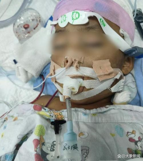 男童被笔扎伤或失明,孩子被笔扎图片视频