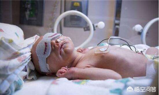 早产娃出保温箱离世,早产孩子在保温箱 早产娃出保温箱离世,早产孩子在保温箱
