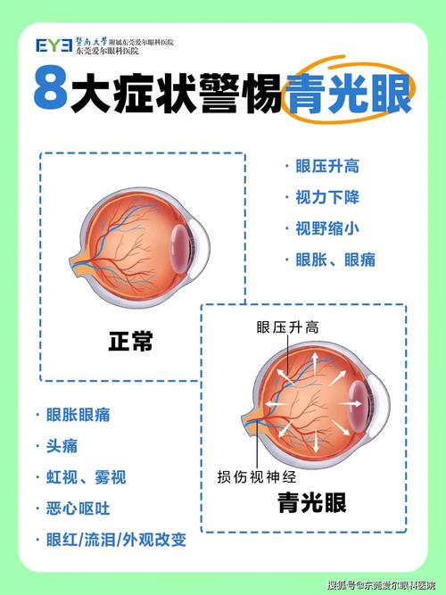 青光眼当感冒险失明,为什么感冒时颅内压和眼压会升高?