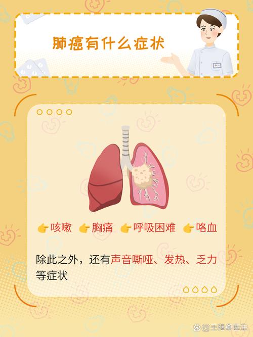 咳嗽不止查出肺癌,老是干咳是肺癌吗?