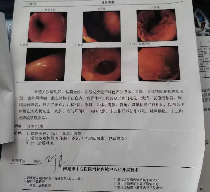 看教程做手术致死亡,我老妈妈早期胃癌在医院做胃全切手术,术后感染导致三天死亡,医院没一点责任吗?