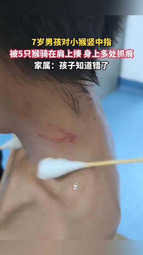 猴打架致胳膊剩骨头,猴打架的图片